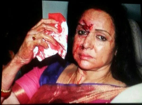 OVERSPEEDING THRILLS BUT KILLS - ACTRESS HEMA MALINI INJURED
