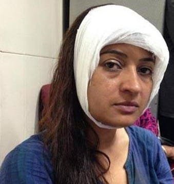 AAP MLA ALKA LAMBA INJURED DURING A CAMPAIGN ,PARTY BLAMES BJP