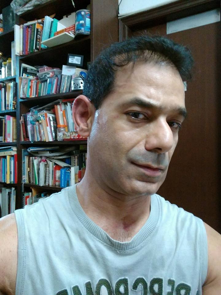 ACE DESIGNER JATTINN KOCHHAR MANHANDLED GETS INJURED..